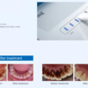 PT7 Periodontal Treatment-Device 1780-3 Détartreur ultrasonique REFINE PT7 avec irrigation – Scaler dentaire