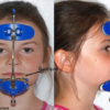 masque de Petit